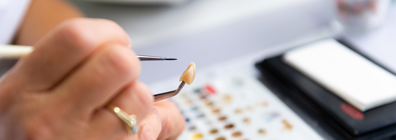 Schöne Zähne mit Veneers, Bleaching Lüdenscheid